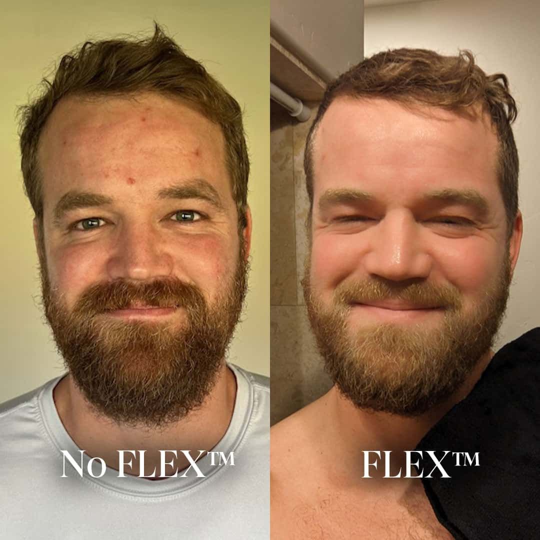 Before and After Result 2
